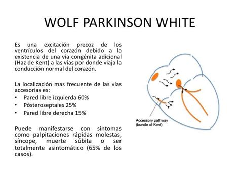 Wolf Parkinson White