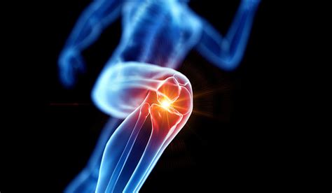 What Shoes Work Best With Arthritic Knees Comprehensive Orthopaedics