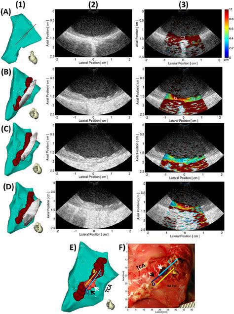 Column 1 Electroanatomical Maps Of Canine Right Atrium RA The