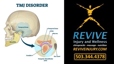 Tmj Jaw Pain Relief Chiropractic Care Help With Tmj Jaw Pain