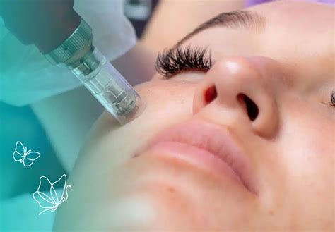 Rejuvenate Your Skin With Microneedling Treatment In San Antonio Tx