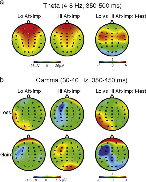 Figure 2 From EEG Oscillatory Activity Associated To Monetary Gain And