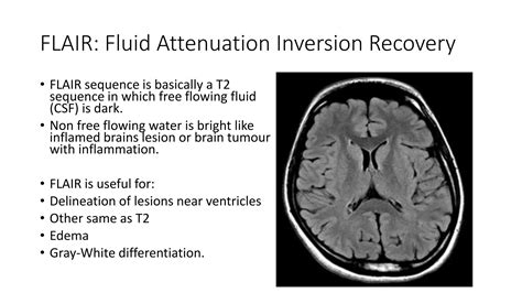 Mri Brain Sequences Ppt