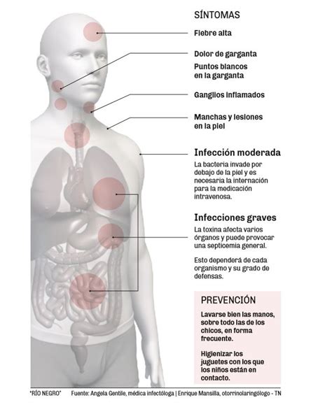 Estreptococo C Mo Se Contagia Y Cu Les Son Los S Ntomas