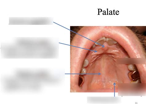 Palate Diagram Quizlet