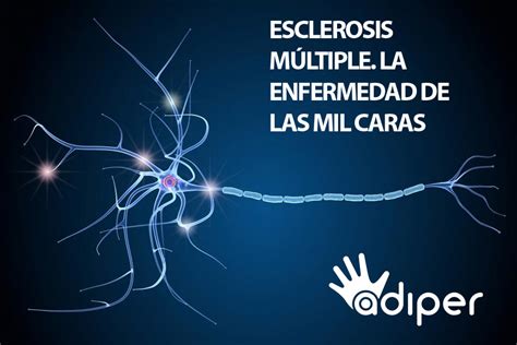 ¿qué Es La Esclerosis Múltiple La Enfermedad De Las Mil Caras Adiper Ayuda A Domicilio