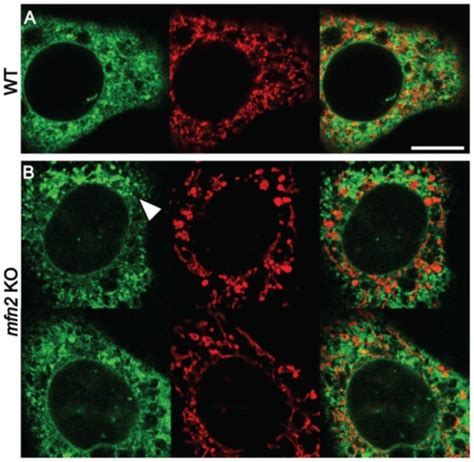 Fluorescence Analysis Of Er And Mitochondriawt A And Open I