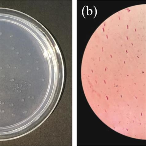 Microscopic Morphological Characteristics Of Strain T 07 A Colony