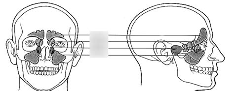 Paranasal Sinuses Diagram | Quizlet