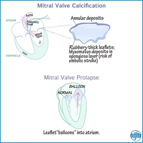 valvular pathologies artofit