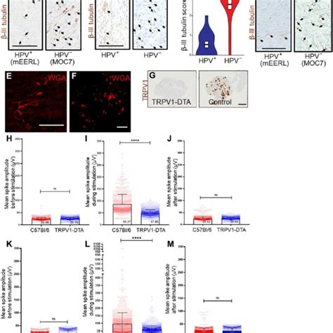 Electrical Activity From Trpv1 Expressing Neurons Photomicrographs Of