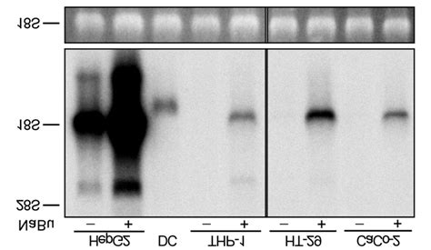 30 Effect Of Butyrate Treatment On Hep27 Mrna Expression In Different