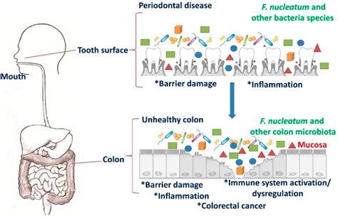 Cancers Free Full Text Targeting Programmed Fusobacterium Nucleatum