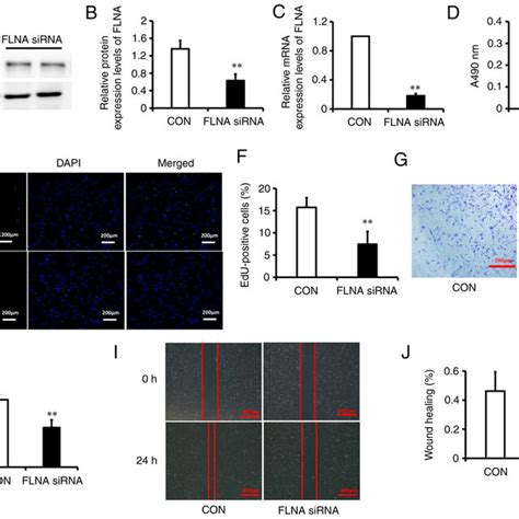 Flna Knockdown Inhibits Proliferation And Migration Of Pasmcs A