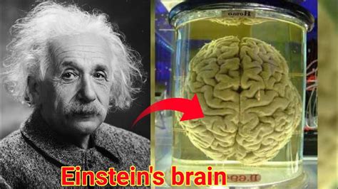 How Albert Einstein Brain Is Really Different Than Other Einstein Facts By Story Cover Youtube