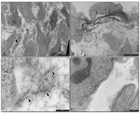 Tem Analysis Showing Mg63 Cells Grown On 3d Scaffold A After 14 Days Download Scientific