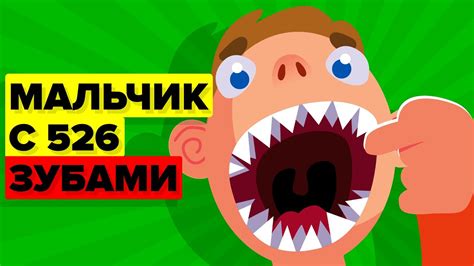 Мальчик-акула с 526 зубами (реальная история) - YouTube