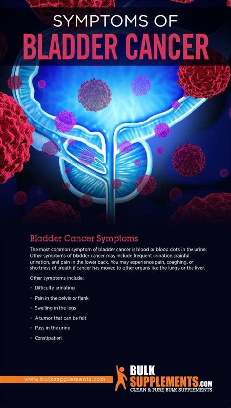 Bladder Cancer: Symptoms, Causes & Treatment