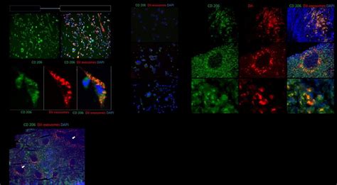 Targeting efficiency and specificity of CD206-positive M2... | Download ...