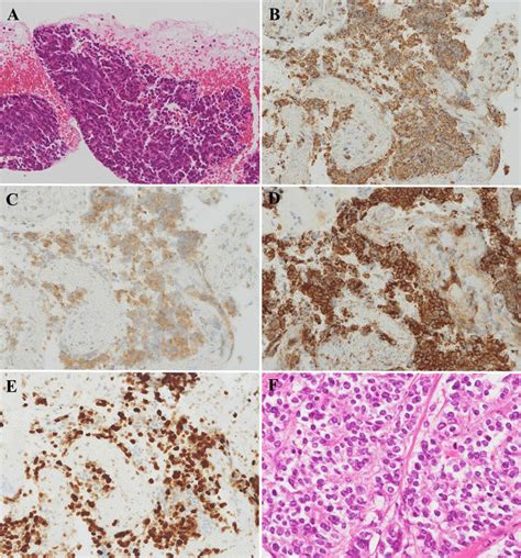 Histopathological And Immunohistochemical Findings Photomicrographs Download Scientific