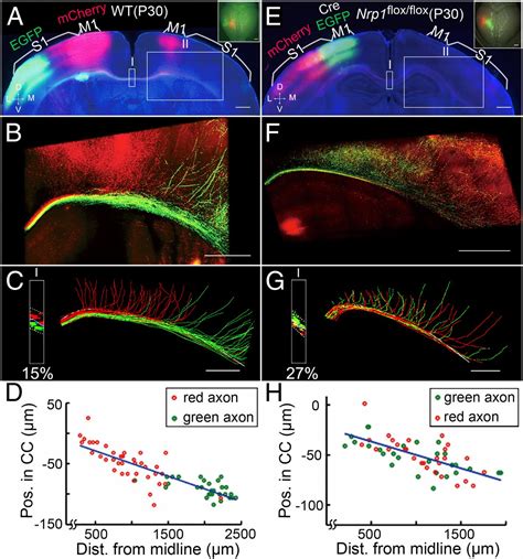 Axon Position Within The Corpus Callosum Determines Contralateral