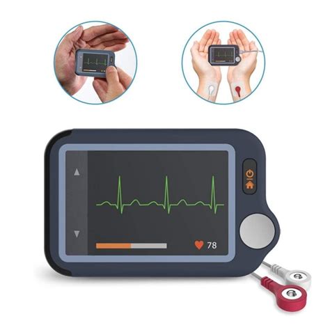 Personal ECG Monitor | Surgical Supplies | Medical Devices NZ