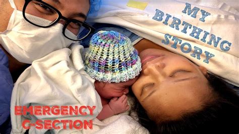 My Birth Story Emergency C Section Experience Youtube