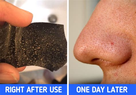 Blackhead Nose Strips