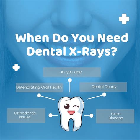 Dental X Rays To Control Your Oral Health Kwc Dental Kwc Dental