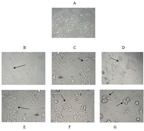 Morphological Analysis Fig A Represents Normal HCT 15 Cell Line