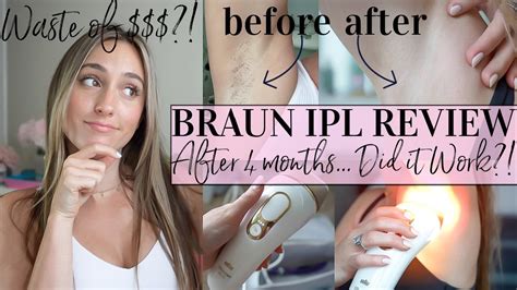 Braun Ipl Review Did It Work Months Later Hair Removal Review