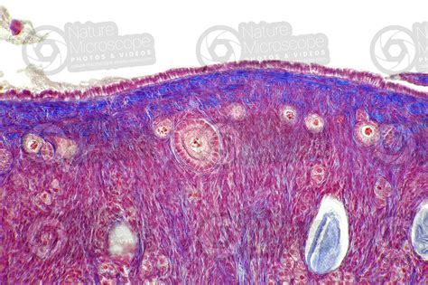 Rat Ovary Transverse Section 125x Rat Mammals Reproductive