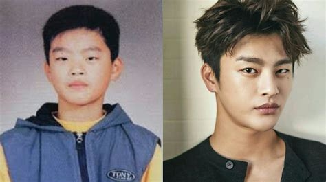 Seo In Guk Before And After