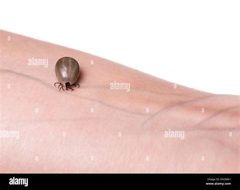 Tick Crawling On A Human Skin Stock Photo Alamy