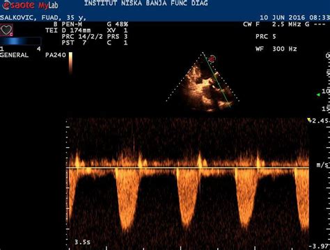ultrasound   heart   scientific diagram