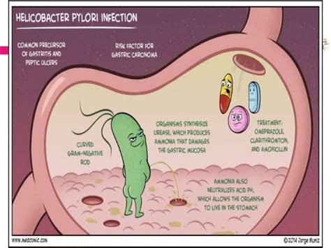 Helicobacter Pylori