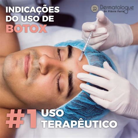 Indicações do uso de toxina botulínica Uso terapêutico A indicação do