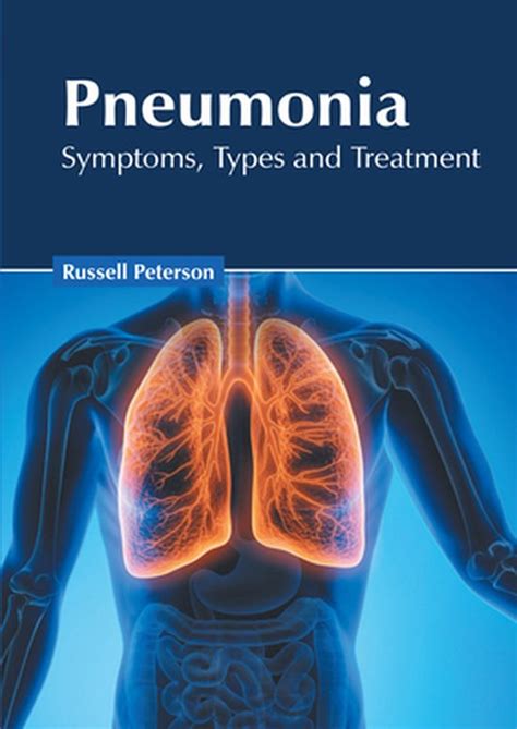 Pneumonia Symptoms Types And Treatment 9781632429278 Boeken Bol