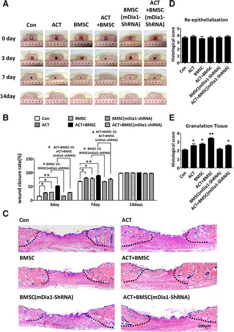 Mdia1 Regulates Activin B Induced Bone Marrow Derived Mesenchymal Download Scientific Diagram