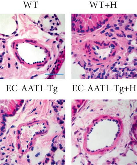 Increased Ec Derived So Ameliorates Hypoxia Induced Ph A