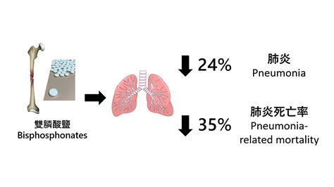 HKUMed Finds That An Anti Osteoporosis Drug Is Associated With Reduced