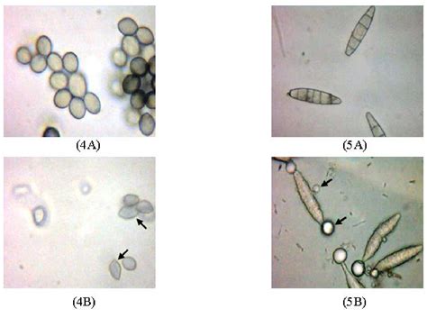 Figure 4 From Evaluation Of Antifungal Activity In Essential Oil Of The Syzygium Aromaticum L