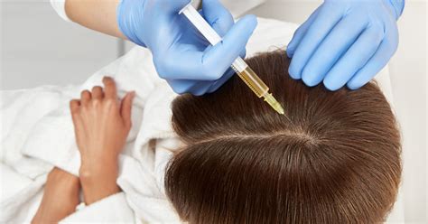 Complete Guide To Hair Mesotherapy پیکاپ سرمایه