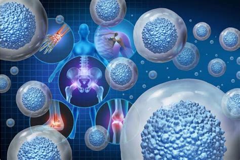 Cooled Radiofrequency Ablation For Pain