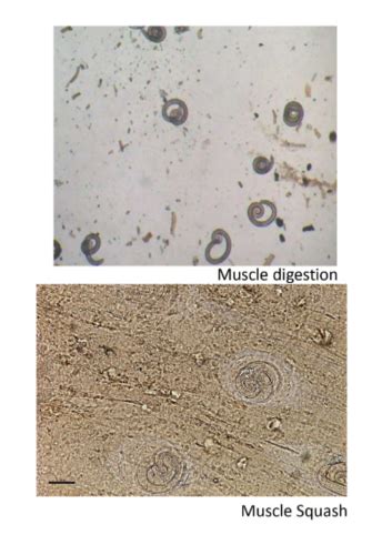 Swine Trichinella Taenia Protozoa Flashcards Quizlet