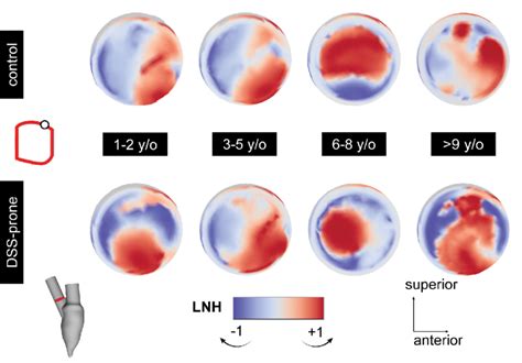 Figure E 9 Snapshots Of The Left Ventricular Outflow Tract Lvot