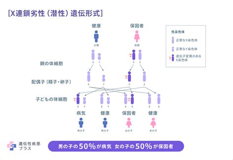 原発性免疫不全症候群 遺伝性疾患プラス