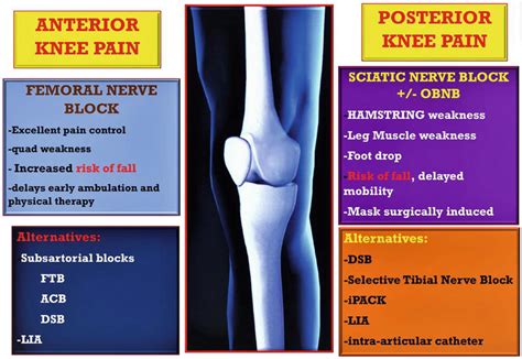 Regional Analgesia For Knee Surgeries Thinking Beyond Borders Intechopen