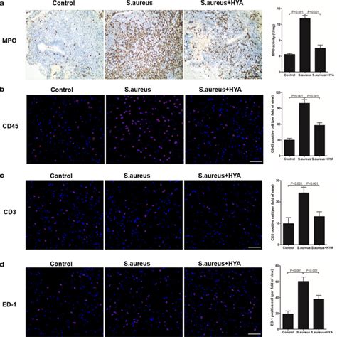 HYA Reduces The Infiltration Of Inflammatory Cells In Uterine A