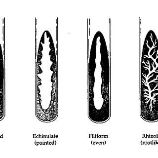 Streak Plate Technique For Pure Culture Isolation Of Bacteria The